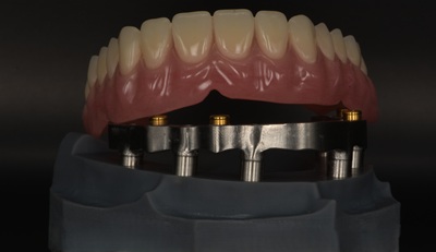 Non-ferrous metals